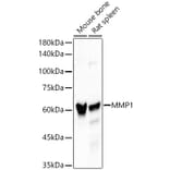 Western Blot - Anti-MMP1 Antibody [ARC55239] (A306151) - Antibodies.com