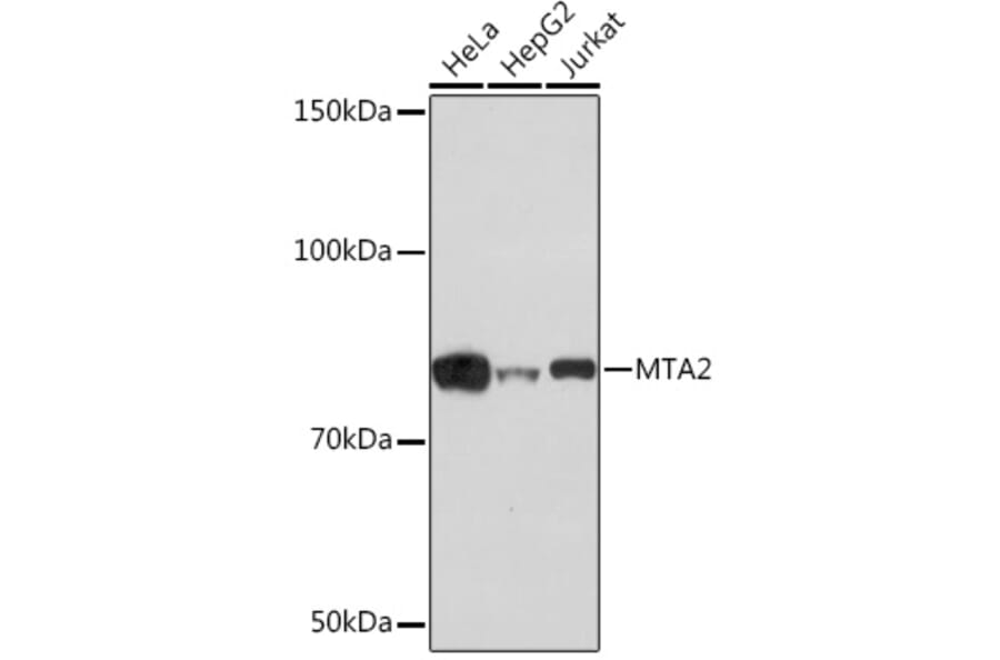 Western Blot - Anti-MTA2/PID Antibody [ARC1056] (A306152) - Antibodies.com