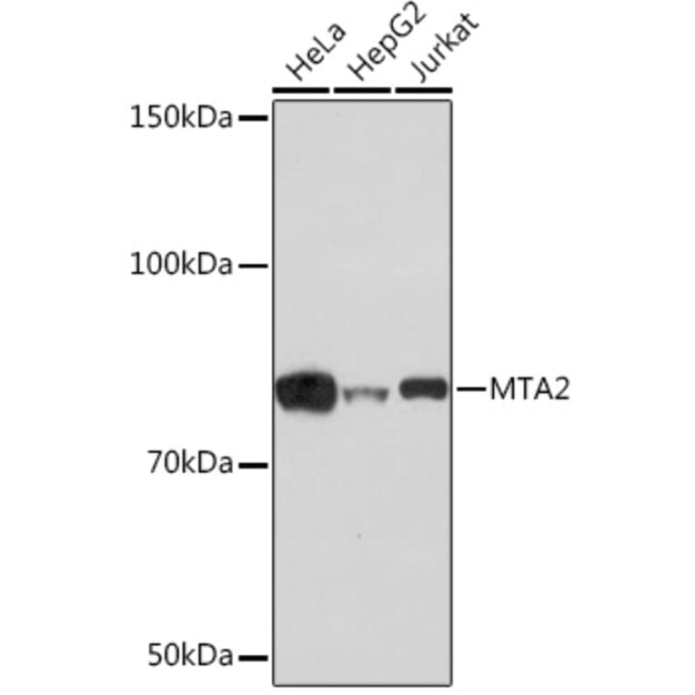 Western Blot - Anti-MTA2/PID Antibody [ARC1056] (A306152) - Antibodies.com