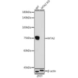 Western Blot - Anti-MTA2/PID Antibody [ARC1056] (A306152) - Antibodies.com