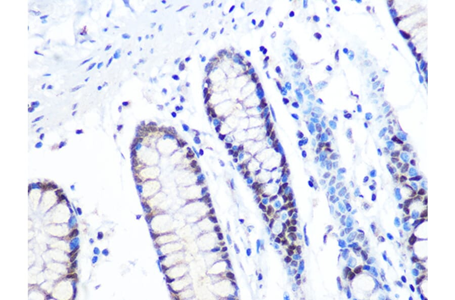 Immunohistochemistry - Anti-MTA2/PID Antibody [ARC1056] (A306152) - Antibodies.com