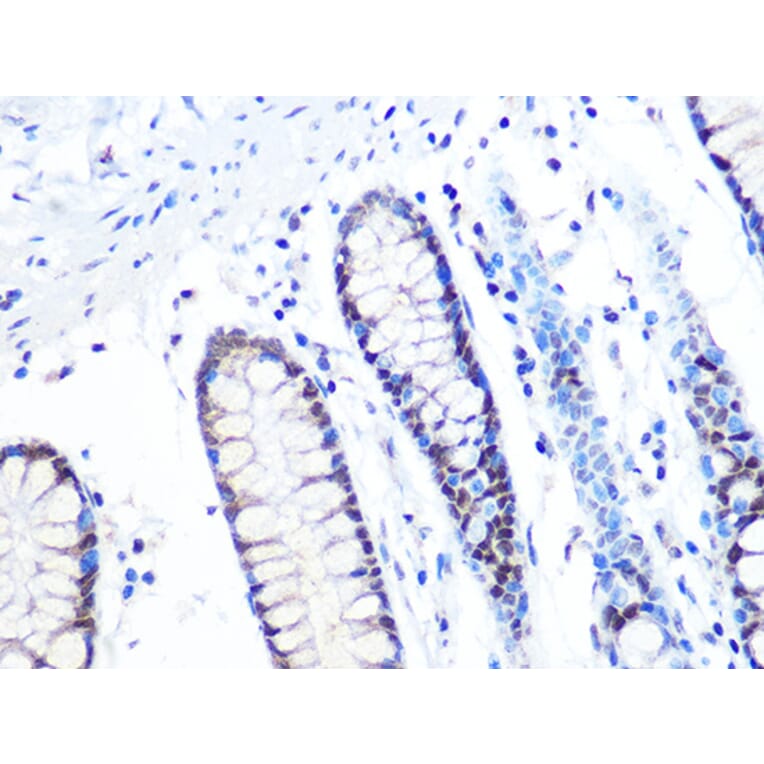 Immunohistochemistry - Anti-MTA2/PID Antibody [ARC1056] (A306152) - Antibodies.com