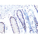 Immunohistochemistry - Anti-MTA2/PID Antibody [ARC1056] (A306152) - Antibodies.com