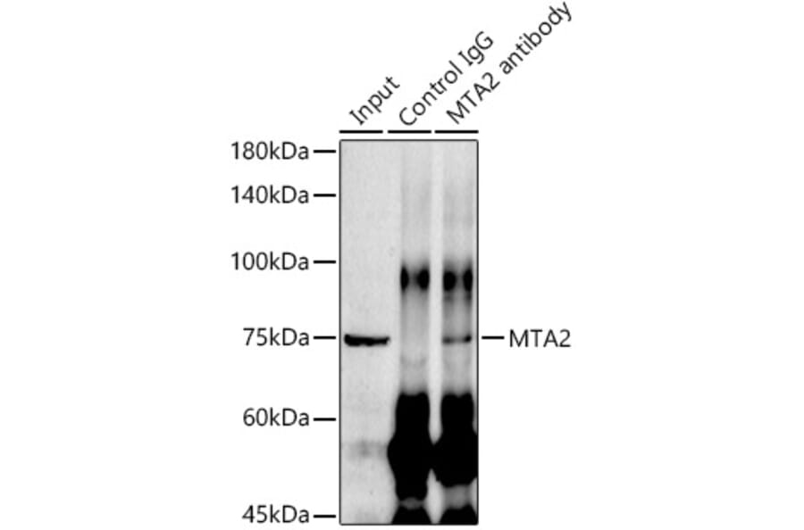 Western Blot - Anti-MTA2/PID Antibody [ARC1056] (A306152) - Antibodies.com