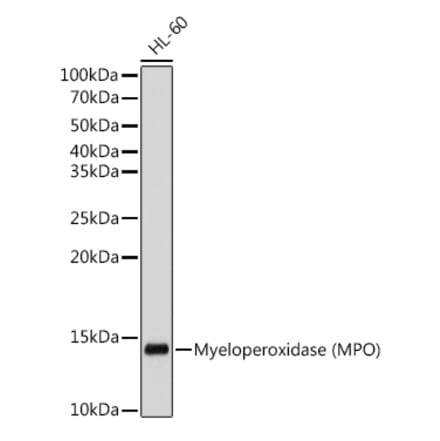 Western Blot - Anti-Myeloperoxidase Antibody [ARC53227] (A306154) - Antibodies.com