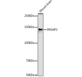 Western Blot - Anti-srGAP2 Antibody (A306156) - Antibodies.com