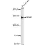 Western Blot - Anti-srGAP2 Antibody (A306156) - Antibodies.com