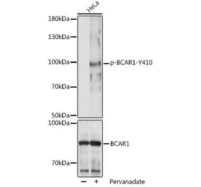 Western Blot - Anti-BCAR1 (phospho Tyr410) Antibody (A306157) - Antibodies.com