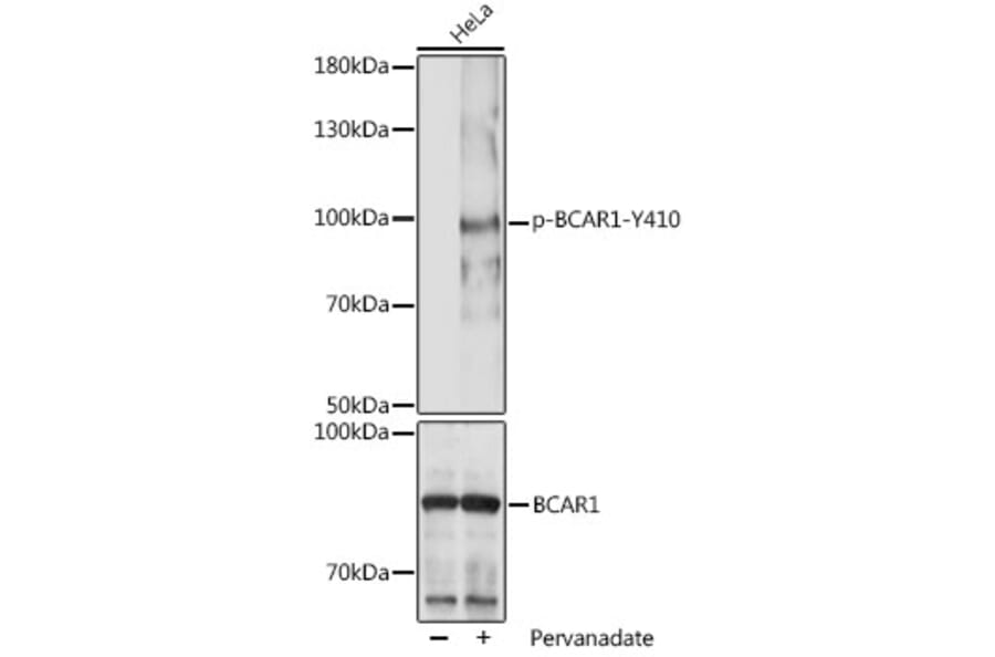 Western Blot - Anti-BCAR1 (phospho Tyr410) Antibody (A306157) - Antibodies.com