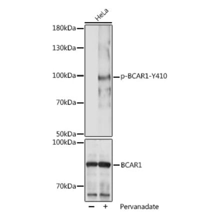 Western Blot - Anti-BCAR1 (phospho Tyr410) Antibody (A306157) - Antibodies.com