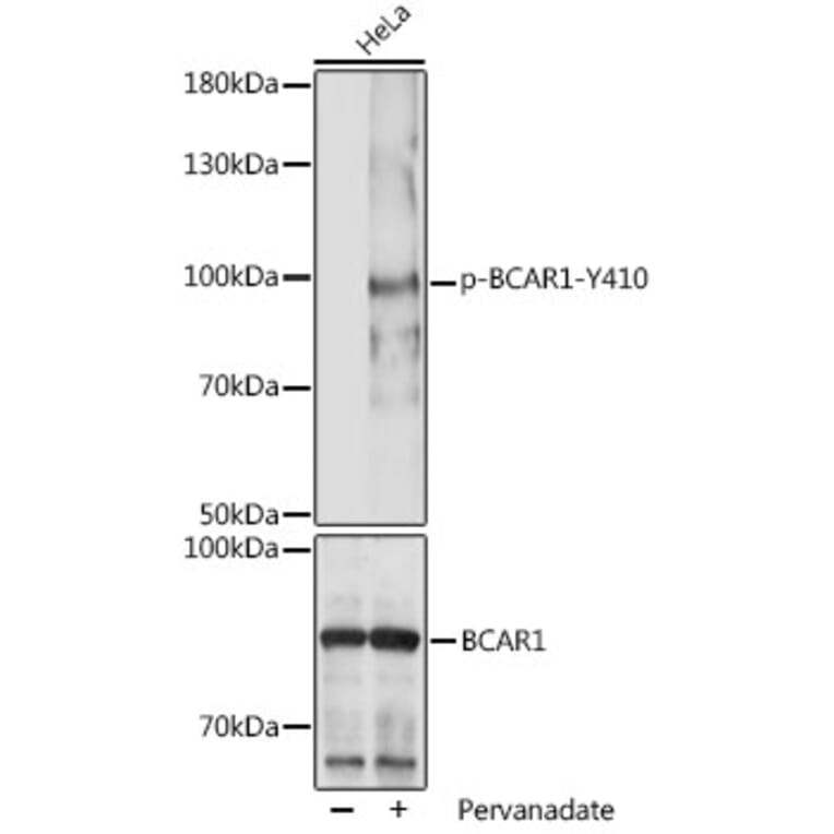 Western Blot - Anti-BCAR1 (phospho Tyr410) Antibody (A306157) - Antibodies.com