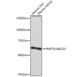 Western Blot - Anti-PMP70 Antibody [ARC2131] (A306158) - Antibodies.com