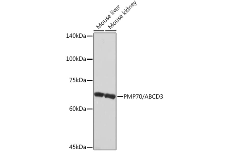 Western Blot - Anti-PMP70 Antibody [ARC2131] (A306158) - Antibodies.com