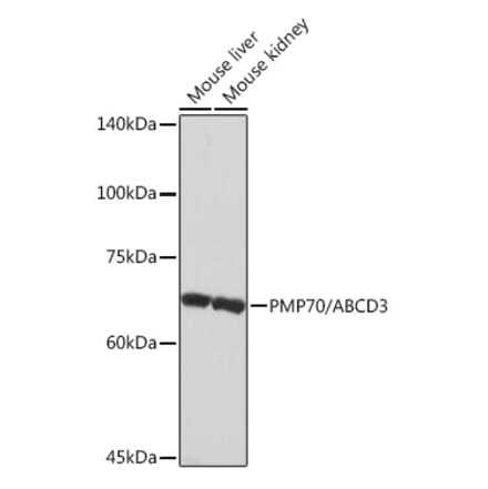 Western Blot - Anti-PMP70 Antibody [ARC2131] (A306158) - Antibodies.com