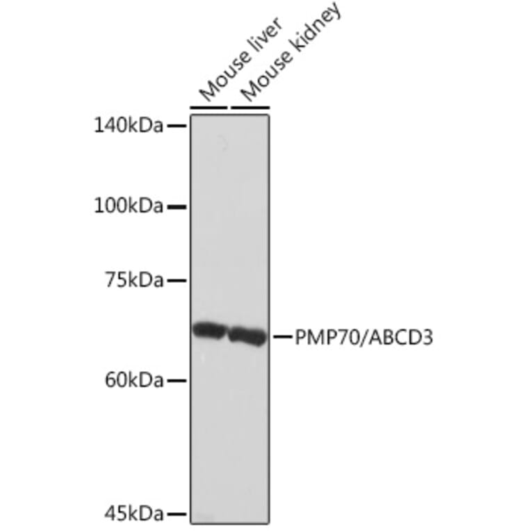 Western Blot - Anti-PMP70 Antibody [ARC2131] (A306158) - Antibodies.com