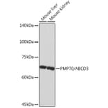 Western Blot - Anti-PMP70 Antibody [ARC2131] (A306158) - Antibodies.com