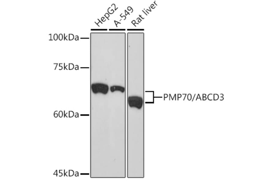 Western Blot - Anti-PMP70 Antibody [ARC2131] (A306158) - Antibodies.com