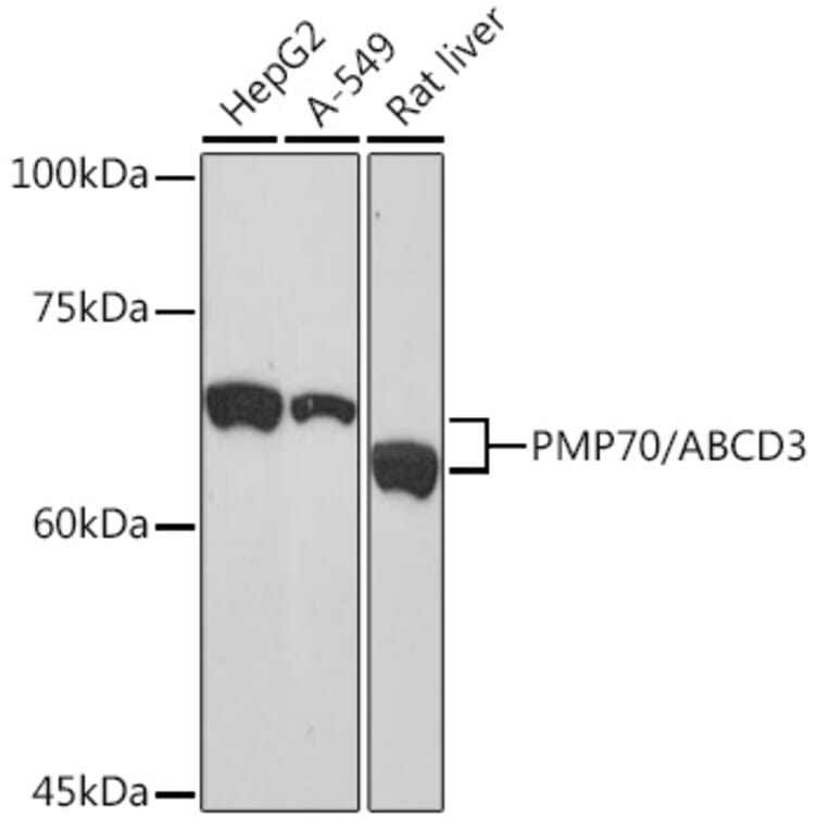 Western Blot - Anti-PMP70 Antibody [ARC2131] (A306158) - Antibodies.com