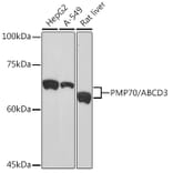 Western Blot - Anti-PMP70 Antibody [ARC2131] (A306158) - Antibodies.com