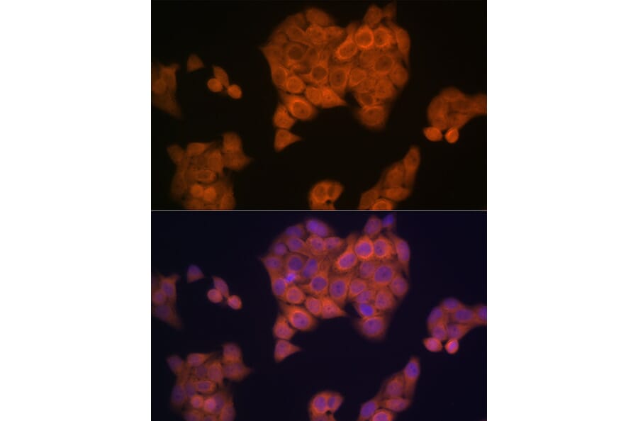 Immunofluorescence - Anti-PMP70 Antibody [ARC2131] (A306158) - Antibodies.com