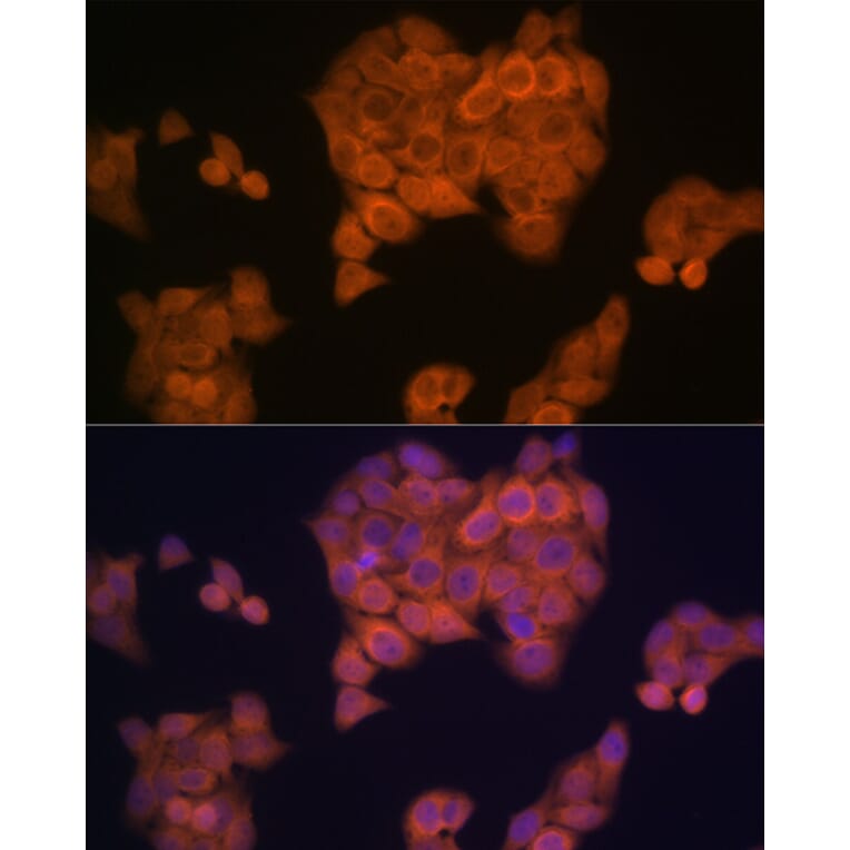 Immunofluorescence - Anti-PMP70 Antibody [ARC2131] (A306158) - Antibodies.com