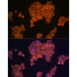 Immunofluorescence - Anti-PMP70 Antibody [ARC2131] (A306158) - Antibodies.com