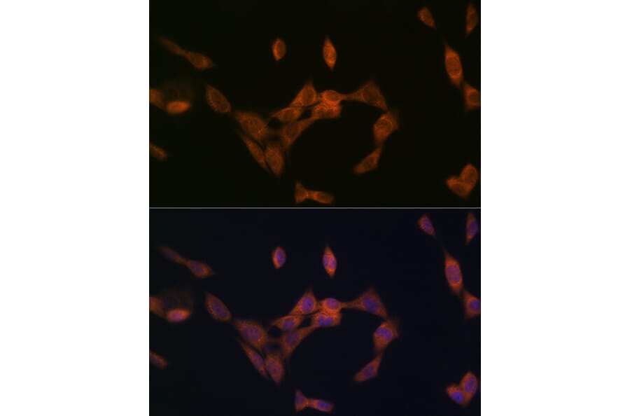 Immunofluorescence - Anti-PMP70 Antibody [ARC2131] (A306158) - Antibodies.com