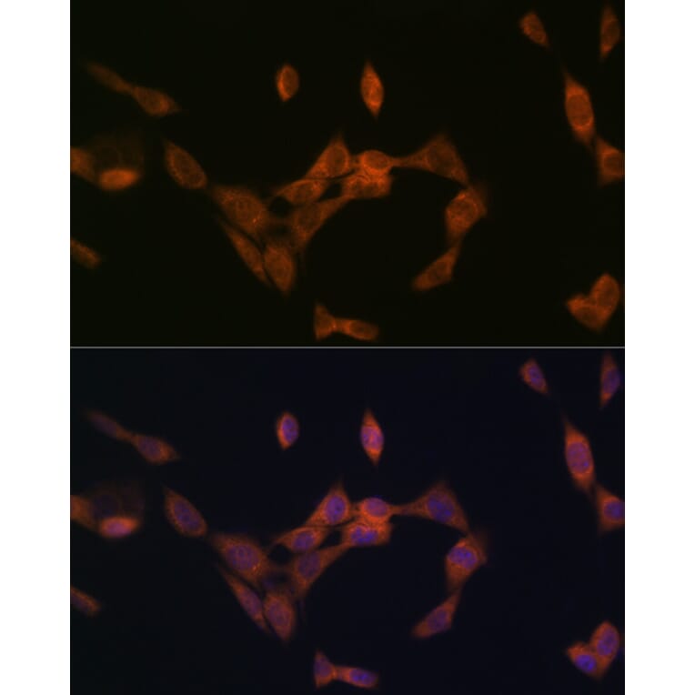 Immunofluorescence - Anti-PMP70 Antibody [ARC2131] (A306158) - Antibodies.com
