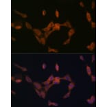 Immunofluorescence - Anti-PMP70 Antibody [ARC2131] (A306158) - Antibodies.com