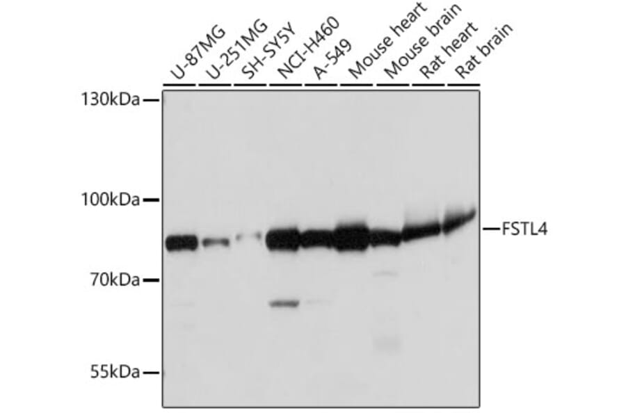Western Blot - Anti-FSTL4 Antibody (A306160) - Antibodies.com