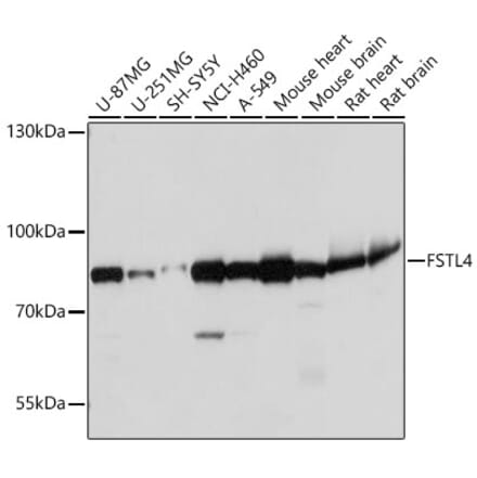 Western Blot - Anti-FSTL4 Antibody (A306160) - Antibodies.com