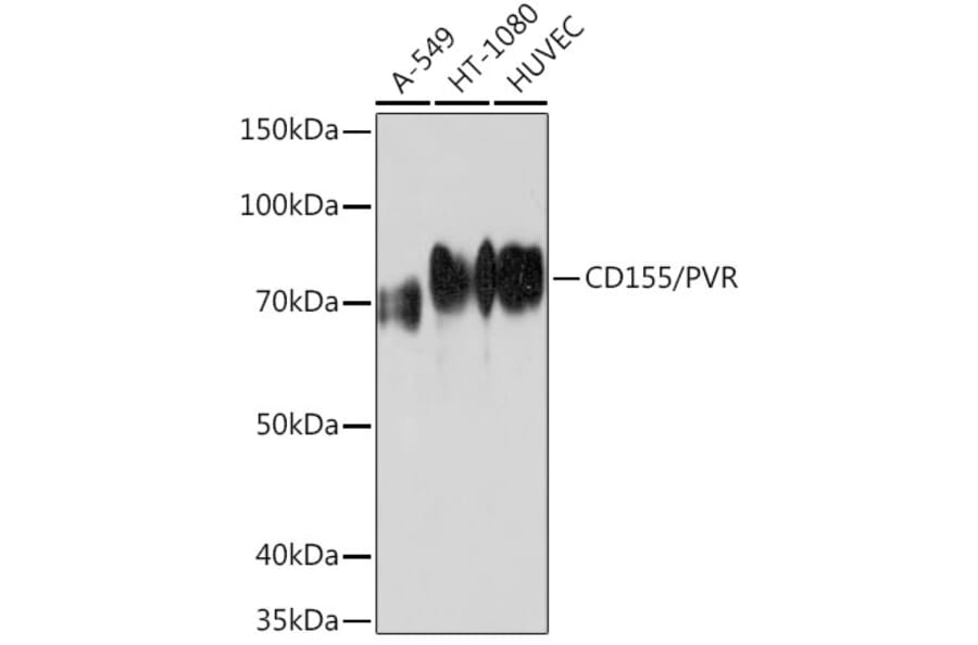 Western Blot - Anti-Poliovirus Receptor/PVR Antibody (A306161) - Antibodies.com