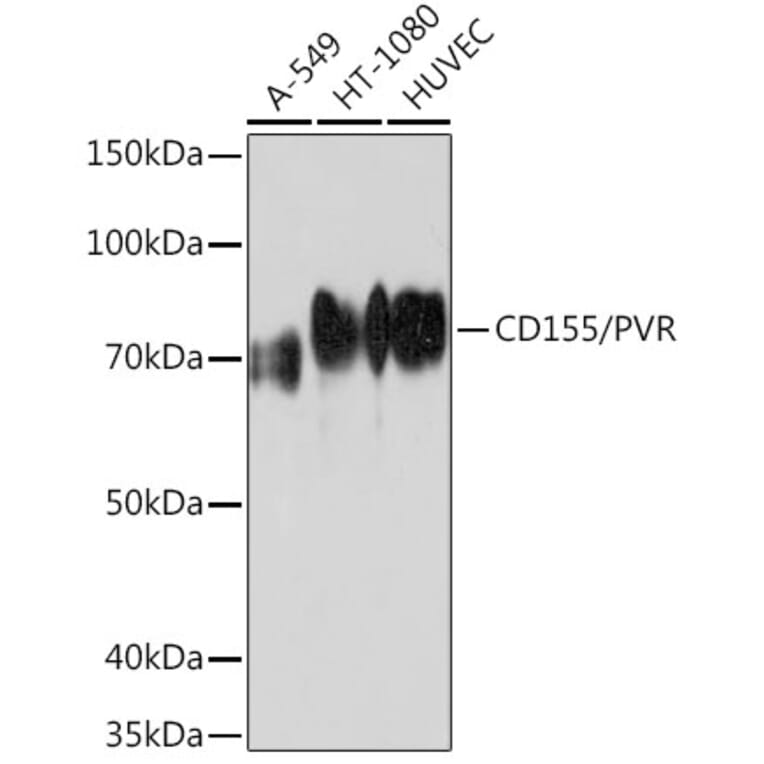 Western Blot - Anti-Poliovirus Receptor/PVR Antibody (A306161) - Antibodies.com