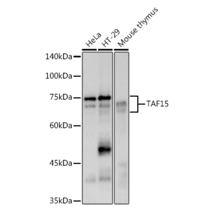 Western Blot - Anti-TAF15 Antibody [ARC2765] (A306162) - Antibodies.com