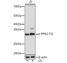 Western Blot - Anti-RPA32/RPA2 (phospho Thr21) Antibody [ARC1586] (A306163) - Antibodies.com