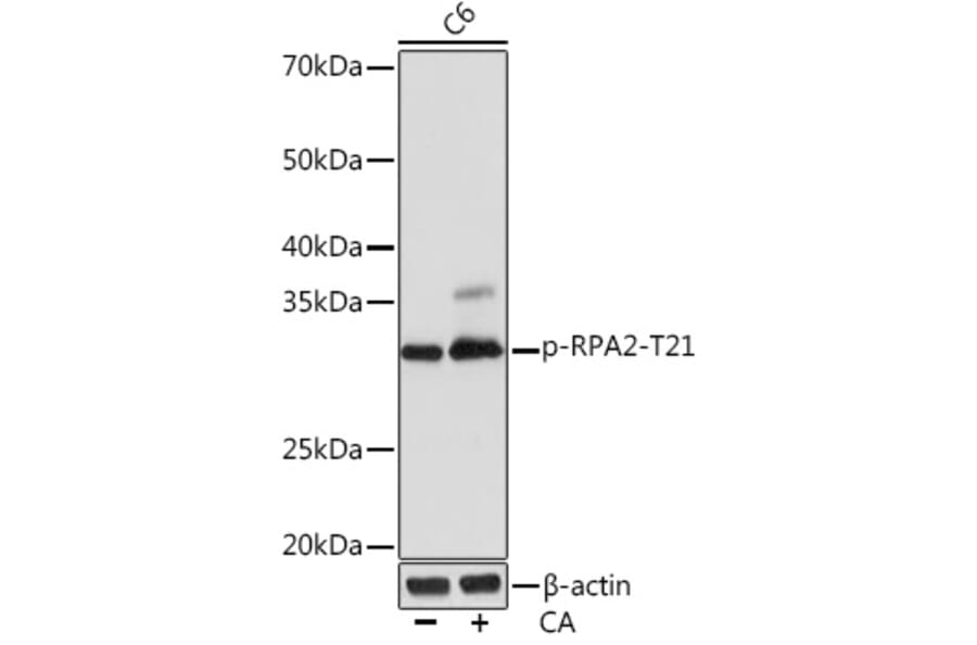 Western Blot - Anti-RPA32/RPA2 (phospho Thr21) Antibody [ARC1586] (A306163) - Antibodies.com