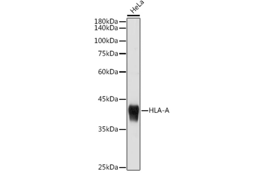 Western Blot - Anti-HLA-A Antibody (A306164) - Antibodies.com