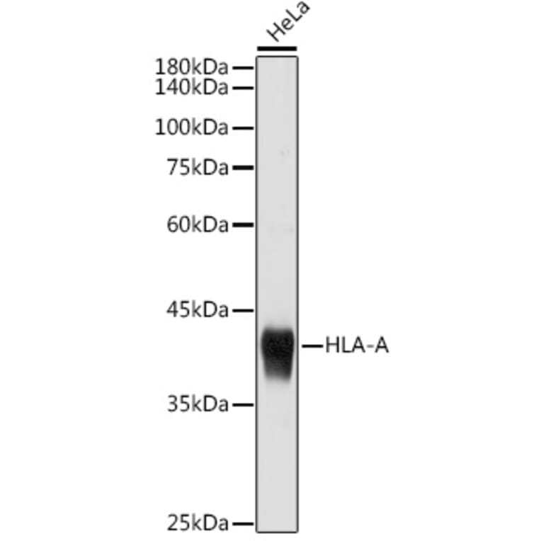 Western Blot - Anti-HLA-A Antibody (A306164) - Antibodies.com