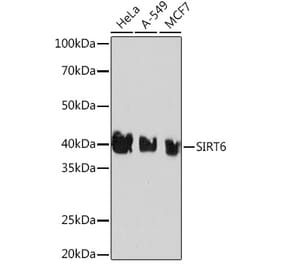 Western Blot - Anti-SIRT6 Antibody [ARC0808] (A306165) - Antibodies.com