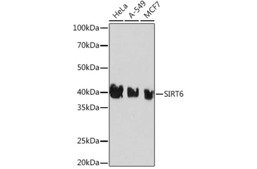 Western Blot - Anti-SIRT6 Antibody [ARC0808] (A306165) - Antibodies.com