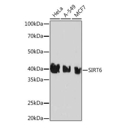 Western Blot - Anti-SIRT6 Antibody [ARC0808] (A306165) - Antibodies.com