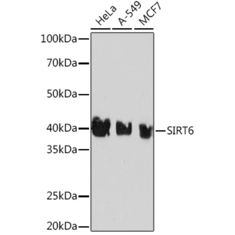 Western Blot - Anti-SIRT6 Antibody [ARC0808] (A306165) - Antibodies.com