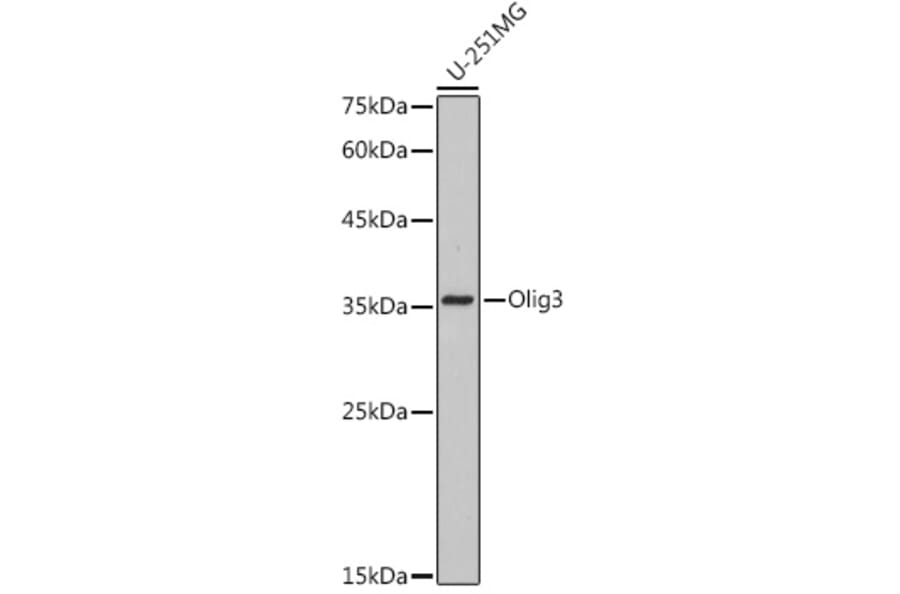 Western Blot - Anti-Olig3 Antibody [ARC2524] (A306166) - Antibodies.com