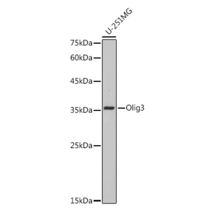 Western Blot - Anti-Olig3 Antibody [ARC2524] (A306166) - Antibodies.com