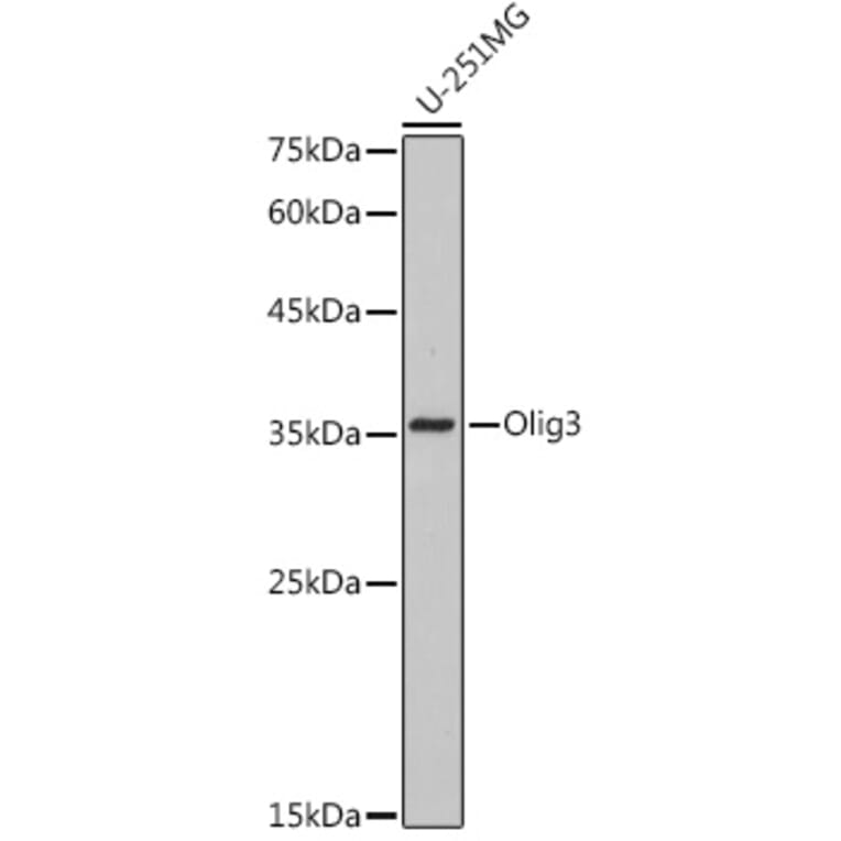 Western Blot - Anti-Olig3 Antibody [ARC2524] (A306166) - Antibodies.com