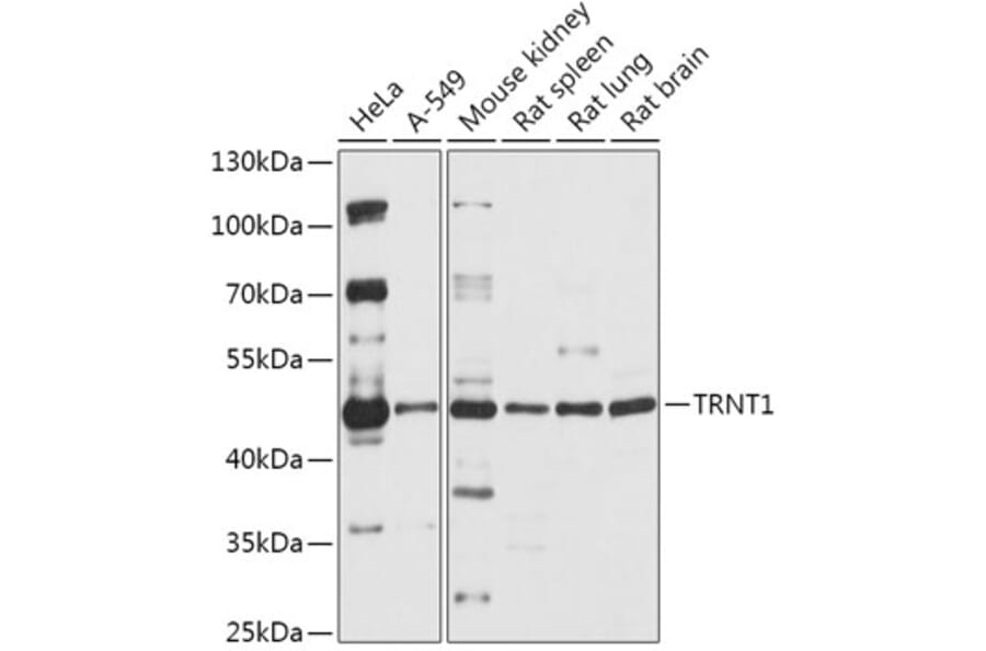 Western Blot - Anti-TRNT1 Antibody (A306167) - Antibodies.com