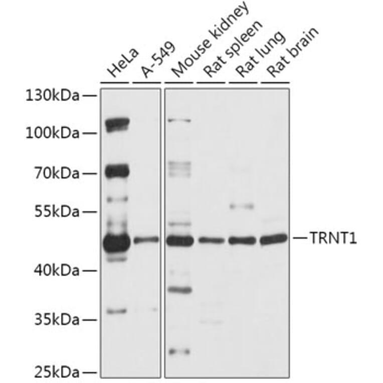 Western Blot - Anti-TRNT1 Antibody (A306167) - Antibodies.com