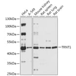 Western Blot - Anti-TRNT1 Antibody (A306167) - Antibodies.com