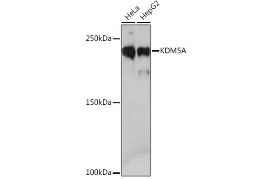 Western Blot - Anti-KDM5A/Jarid1A/RBBP2 Antibody [ARC1120] (A306168) - Antibodies.com