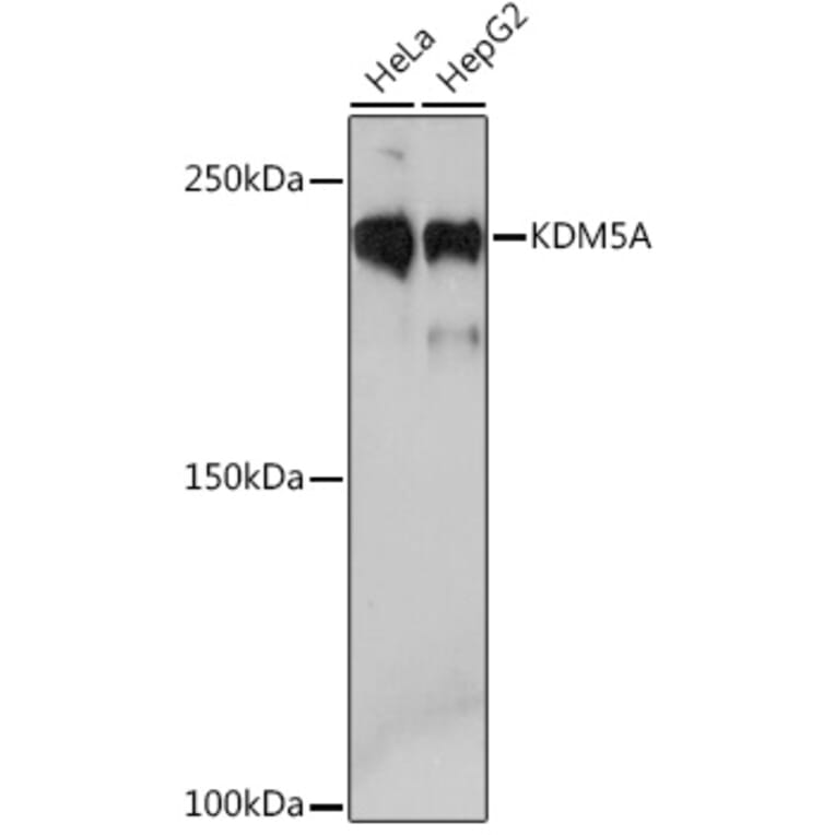 Western Blot - Anti-KDM5A/Jarid1A/RBBP2 Antibody [ARC1120] (A306168) - Antibodies.com